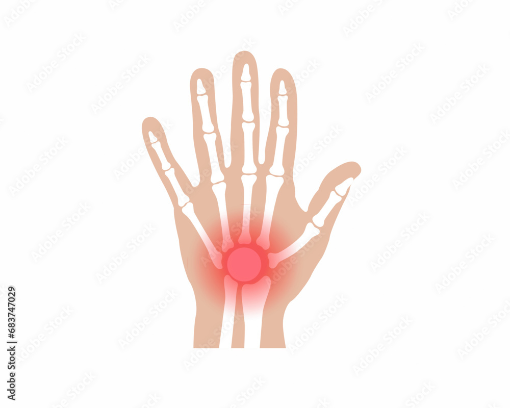 pain-in-finger-joints-arthritis-finger-joint-pain-syndrome-finger