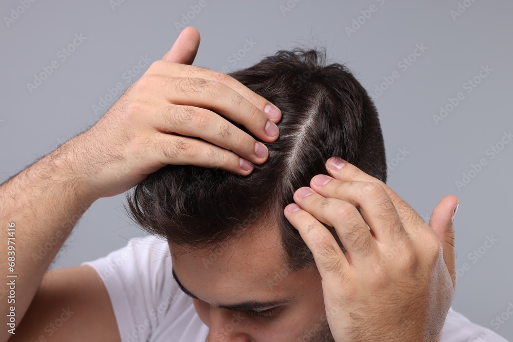 Fototapeta premium Man examining his head on light grey background, closeup. Dandruff problem