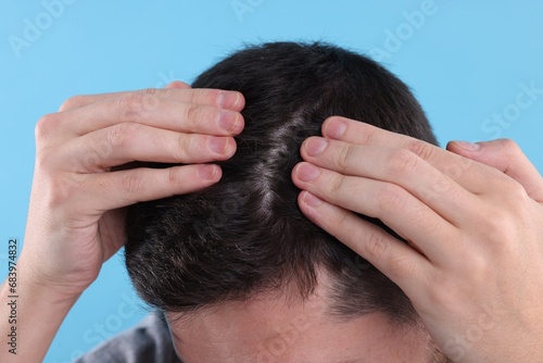 Man examining his hair and scalp on light blue background, closeup