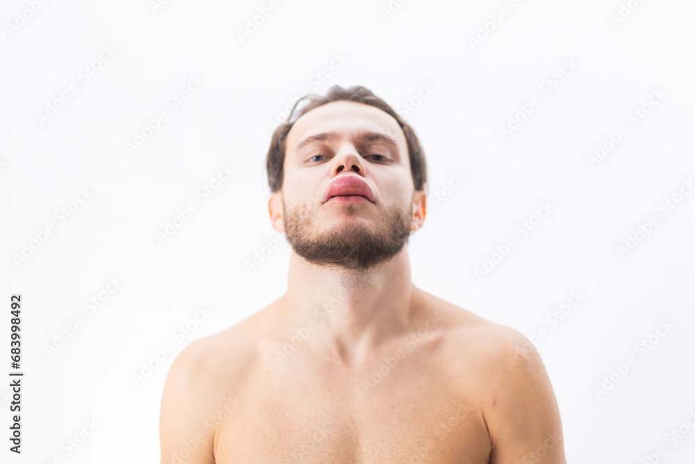 allergic reaction on the lip angioedema in a man, consequences of hyaluronic acid injections