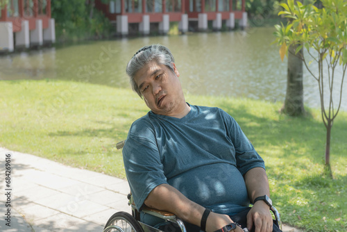 Middle-aged Asian man sitting in a wheelchair The mouth is distorted due to nervous system illness and paralysis. according to the concept of health care photo