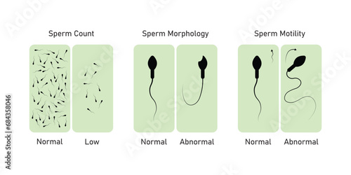 Semen Analysis Scientific Design. Vector Illustration.