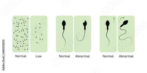 Semen Analysis Scientific Design. Vector Illustration.