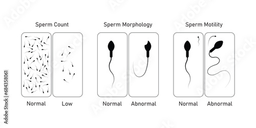 Semen Analysis Scientific Design. Vector Illustration.