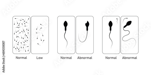 Semen Analysis Scientific Design. Vector Illustration.