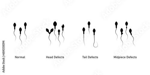 Sperm Morphology Scientific Design. Vector Illustration.