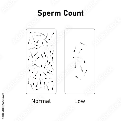 Sperm Count Scientific Design. Vector Illustration.