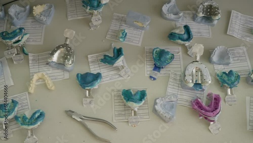 Lots of bite registration mould of dental material at a stomatology clinic. Using dental material impression for production of individual restorations. Recreating patients teeth using dental material. photo