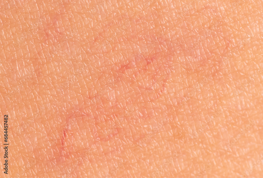 Fototapeta premium Close-up of veins on the skin. Macro