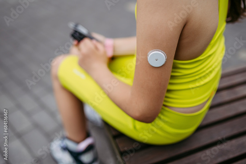 Girl with diabetes checks her blood sugar level on an insulin pump, wearing a CGM sensor photo