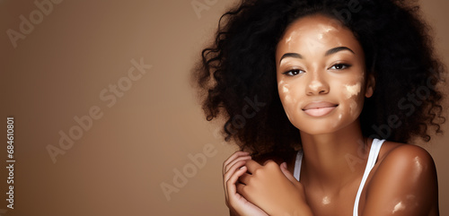 Pretty African american woman portrait - Vitiligo skin condition beauty - Light brown background - copy space - white tank top