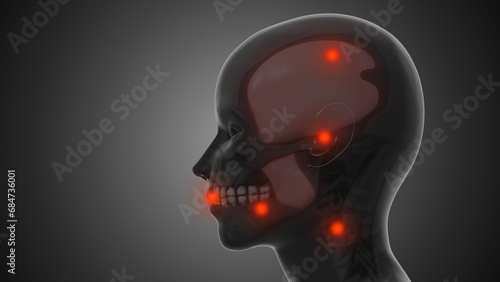 Konstfotografi Trigger points and myofascial pain in the TMJ
