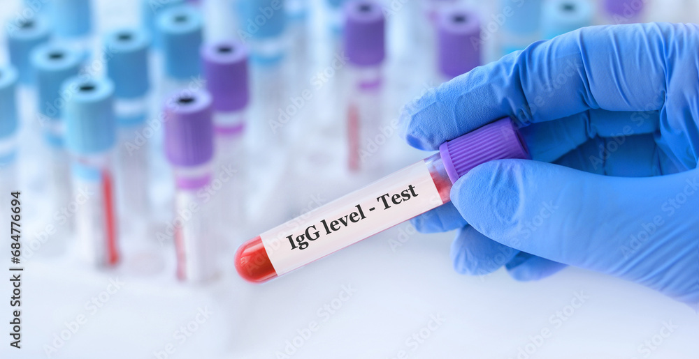 Doctor holding a test blood sample tube with IgG level test on the background of medical test tubes with analyzes Doctor holding a test blood sample tube with IgG level test on the background of medical test tubes with analyzes
