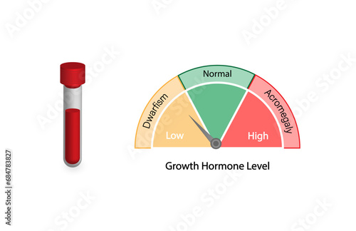 Growth hormone level. Somatotropin. Dwarfism and Acromegaly. Vector illustration. photo