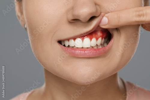 Woman showing inflamed gum on grey background, closeup