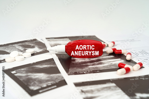 On the ultrasound pictures there are pills and a pen with the inscription - Aortic aneurysm photo