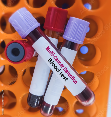 Blood sample for Multi-cancer Early Detection (MCED) Test. Galleri blood test. photo