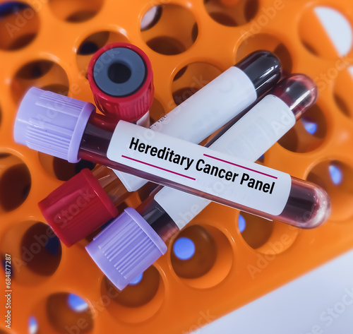 Scientist holding blood sample for hereditary cancer panel(HCP) test to diagnose hereditary cancer syndrome. Detection of 47 genes associated hereditary breast, ovarian, uterine, colorectal cancer. photo