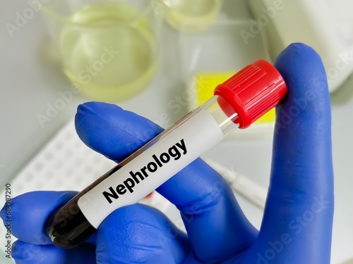 Blood sample for Nephrological studies, Kidney disease diagnosis test. photo