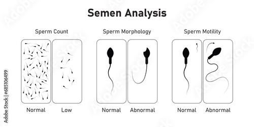 Semen Analysis Scientific Design. Vector Illustration.