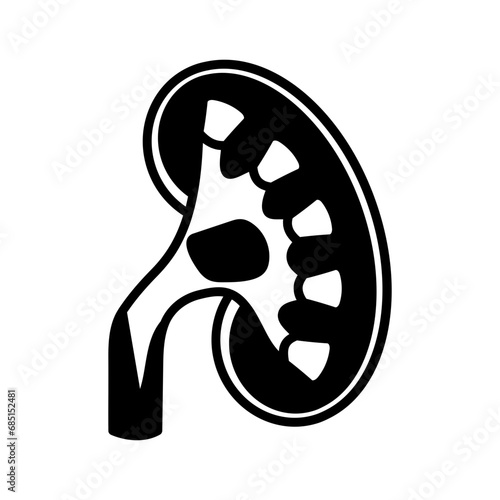 Renal Pelvis icon in vector. Logotype