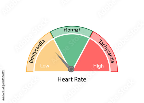 Heart rate, rhythm of the heart. Tachycardia and Bradycardia. ECG, supraventricular tachycardia and sinus bradycardia. Ventricular fibrillation. Arrhythmia. Vector illustration.