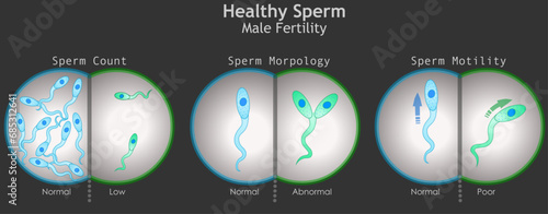 Sperm healthy, male fertility. Microscopic cells compare. Count, morphology, motility. Compare, normal, low, abnormal, poor. Semen movement shape. Test tube baby, IVF. Dark Illustration vector