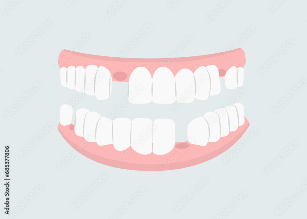 Fototapeta premium Mouth with teeth concept. Oral hygiene and cleanliness, stomatology. Problems with teeth. Health care and treatment. Poster or banner. Cartoon flat vector illustration isolated on grey background