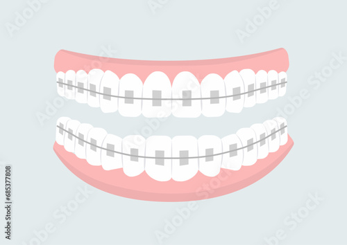 Mouth with teeth concept. Oral hygiene and cleanliness, stomatology. Mouth with braces. Diagnosis and treatment. Cover or banner. Cartoon flat vector illustration isolated on grey background
