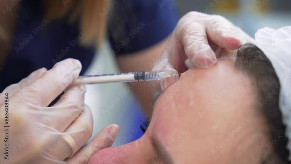 Beautician doctor makes botox injection in the forehead of young beautiful woman. Extreme close up 4k shot Beautician doctor makes botox injection in the forehead of young beautiful woman. Extreme close up 4k shot