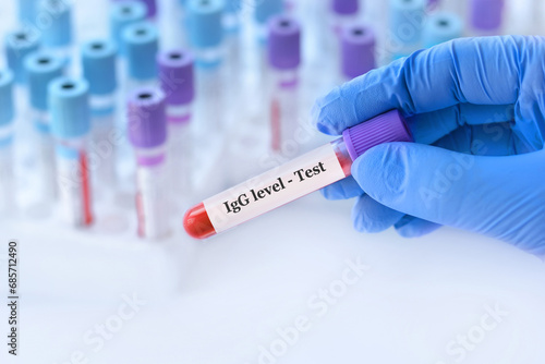 Doctor holding a test blood sample tube with IgG level test on the background of medical test tubes with analyzes photo