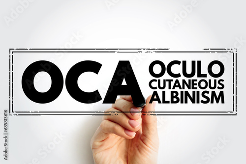 OCA Oculocutaneous Albinism - genetic disorder characterized by skin, hair, and eye hypopigmentation due to a reduction or absence of melanin, acronym text stamp concept background photo