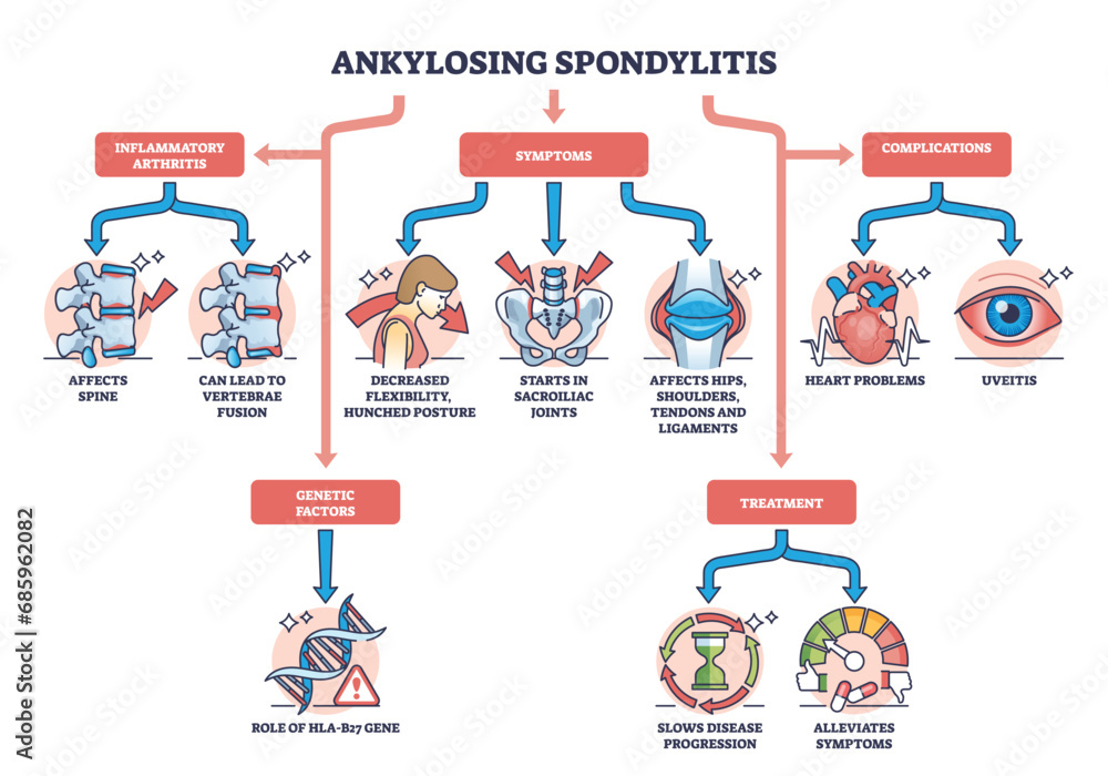 Ankylosing spondylitis as arthritis symptoms or complications outline