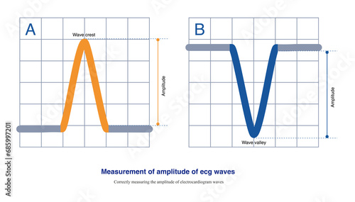 When the polarity of the ECG wave is different, there are two methods for measuring the amplitude of the ECG wave, both of which measure from a certain edge of the baseline to the vertex. photo