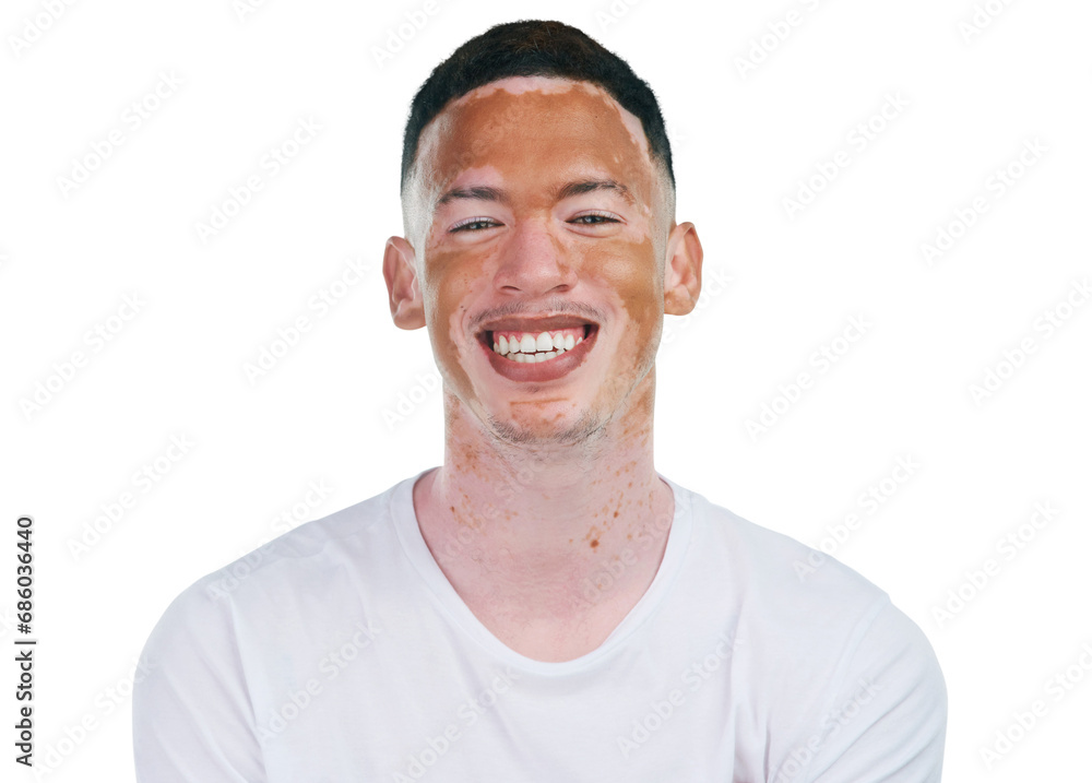 Obraz premium Skincare, portrait or happy black man with vitiligo on isolated, transparent or png background. Smile, face or male model with wellness, treatment or facial, results or hypopigmentation beauty