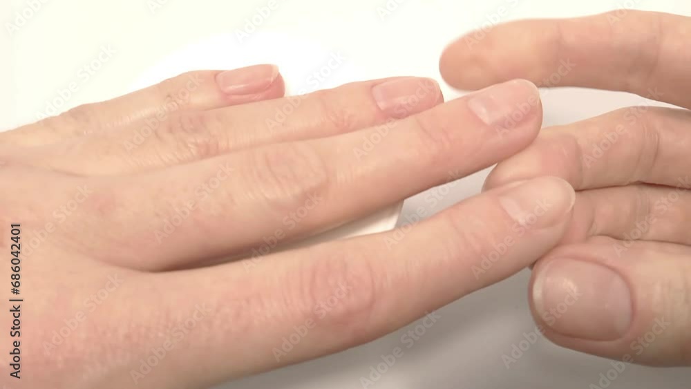 White spots on the fingernails, symptoms of iron deficiency anemia