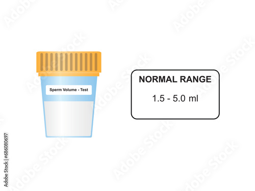 Laboratory Sperm Volume Scientific Design. Vector Illustration.
