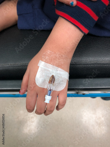 Cannula on the hand of a young girl