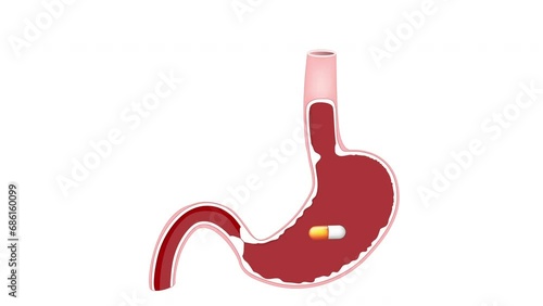 Stomach with medicine pill. Capsule with medicaments like Vitamins, supplements, antibiotic or painkiller. 2d animation photo