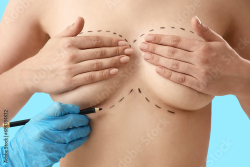 Plastic surgeon drawing mar...