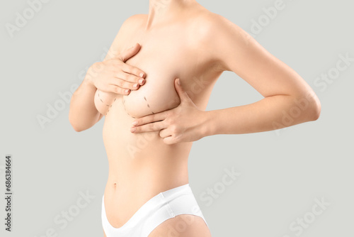 Young woman with marks on h...