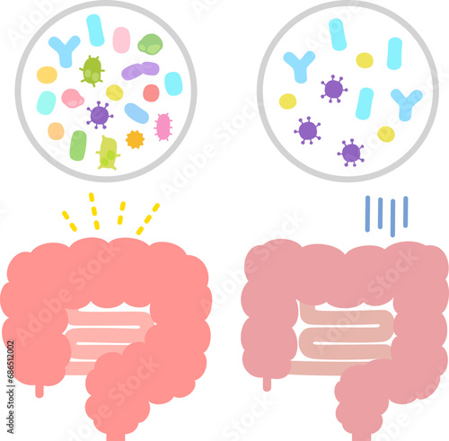腸内細菌の多様性がある腸とない腸 photo