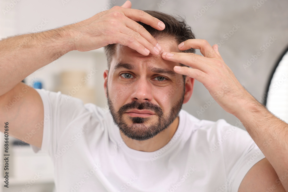 Skin problem. Confused man touching his face at home Skin problem. Confused man touching his face at home