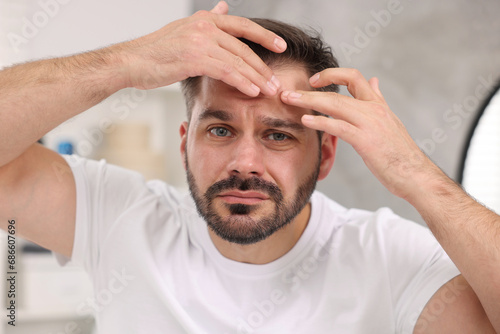 Skin problem. Confused man touching his face at home