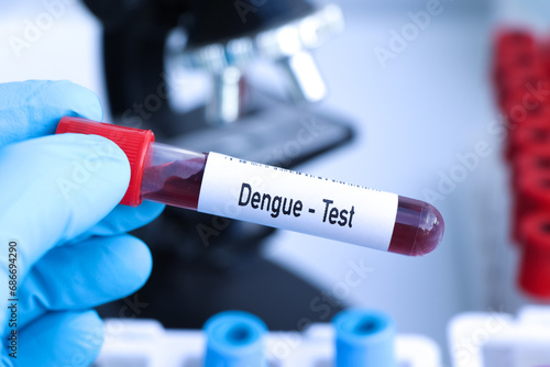 Dengue test to look for abnormalities from blood