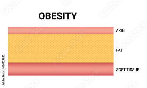 Obesity Science Design Vector Illustration