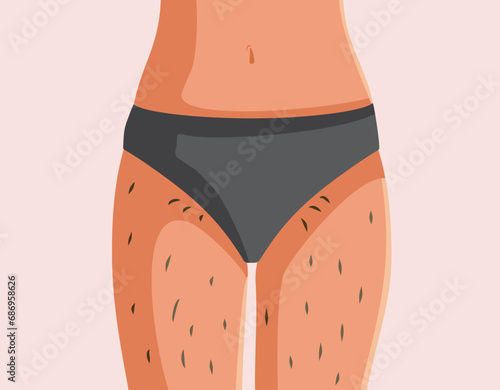 Hairy Female Torso Body Positive Vector Concept Illustration. Woman wearing bikini keeping her natural hairy figure 
