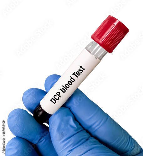 Blood sample for Des-gamma-carboxy prothrombin (DCP) test, to help evaluate whether treatment for one type of liver cancer, hepatocellular carcinoma (HCC). photo