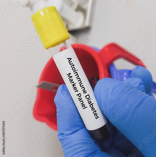 Blood sample for Autoimmune Diabetes marker panel test. photo
