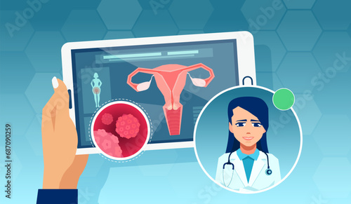 Vector of a female gynecologist giving online advice on HPV infection and screening